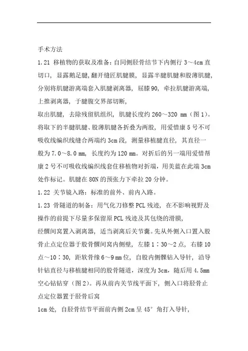 完整word版后交叉韧带重建术