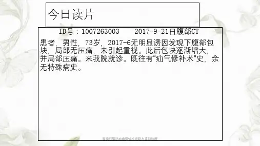 腹膜后脂肪肉瘤影像学表现与鉴别诊断ppt课件