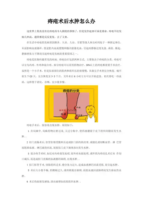 痔疮术后水肿怎么缓解