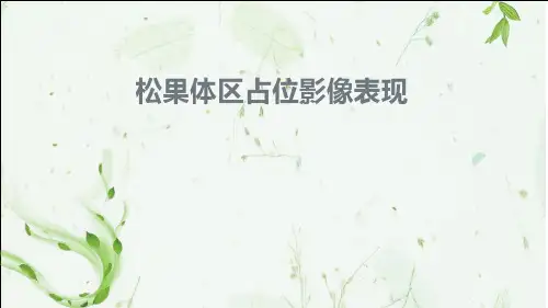 松果体区占位影像表现