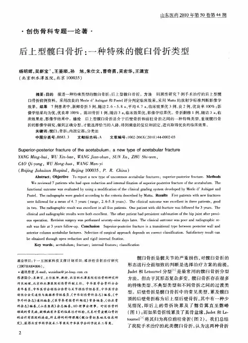 后上型髋臼骨折：一种特殊的髋臼骨折类型