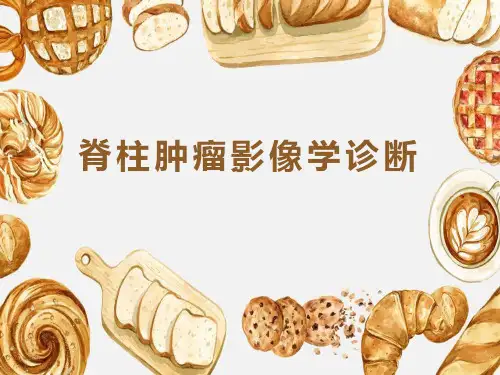 脊柱肿瘤影像学诊断