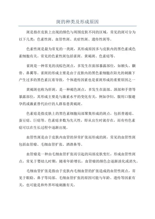 斑的种类及形成原因
