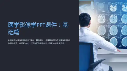 《医学影像学PPT课件：基础篇》