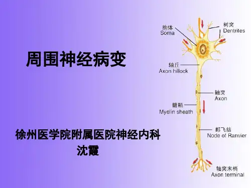 医学专题周围神经病变sx