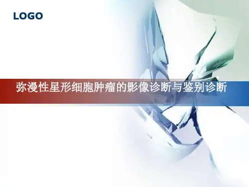 弥漫性星形细胞肿瘤的影像诊断与鉴别诊断