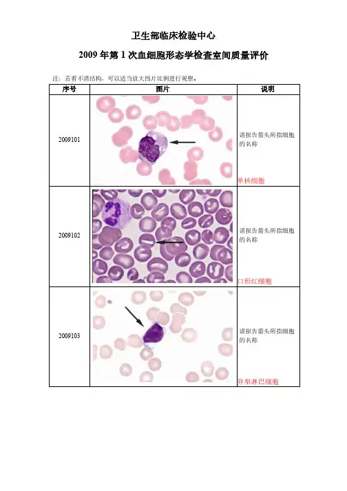 汇总2009-2018 四川省临检中心血细胞形态学图片 室间质量评价