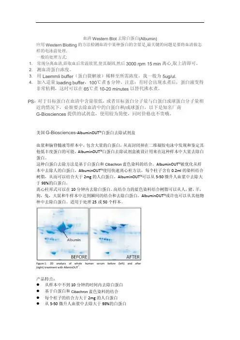 血清Western Blot去除白蛋白(Albumin)
