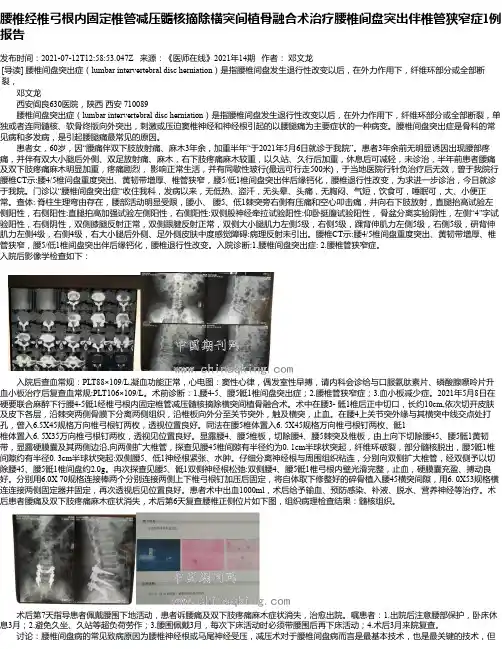 腰椎经椎弓根内固定椎管减压髓核摘除横突间植骨融合术治疗腰椎间盘突出伴椎管狭窄症1例报告