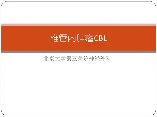 椎管内肿瘤