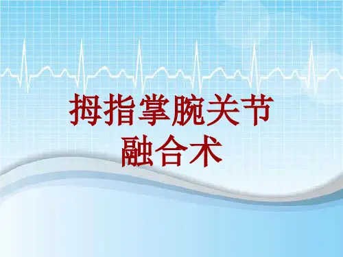 手术讲解模板：拇指掌腕关节融合术