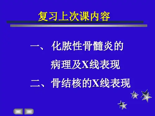 良恶性骨肿瘤鉴别诊断
