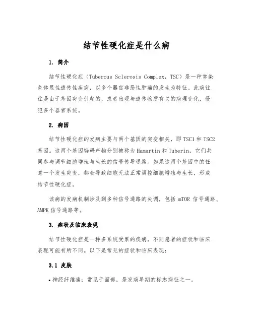 结节性硬化症是什么病