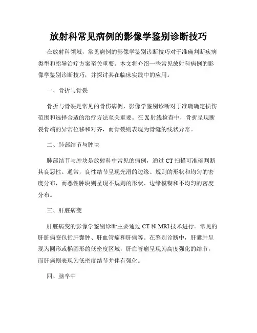 放射科常见病例的影像学鉴别诊断技巧