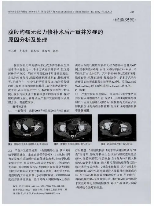 腹股沟疝无张力修补术后严重并发症的原因分析及处理