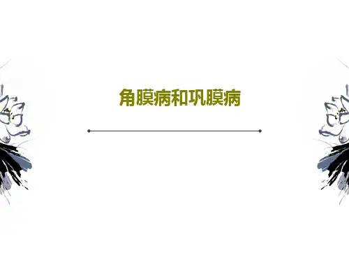 角膜病和巩膜病PPT共47页
