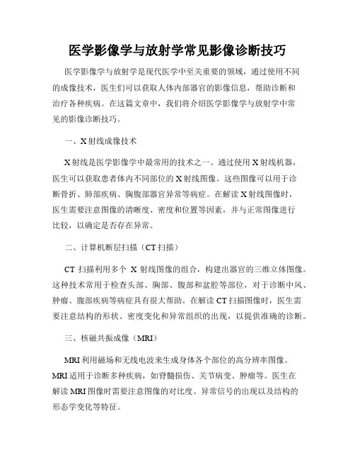 医学影像学与放射学常见影像诊断技巧