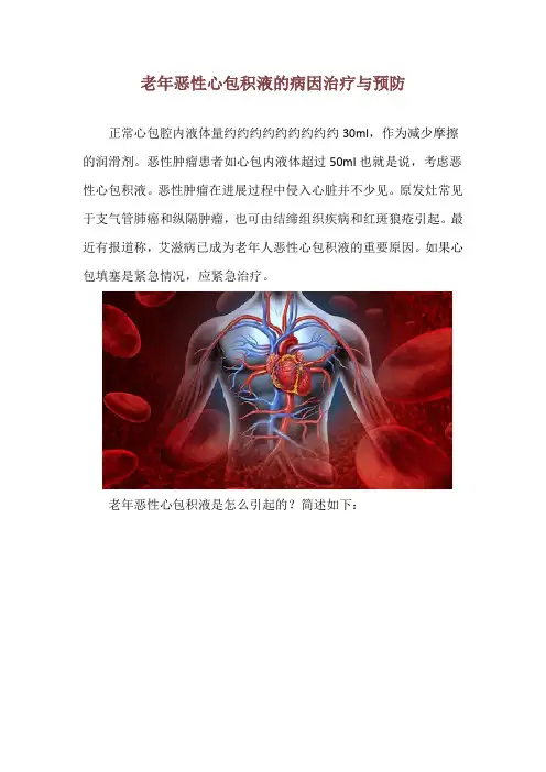 老年恶性心包积液的病因治疗与预防