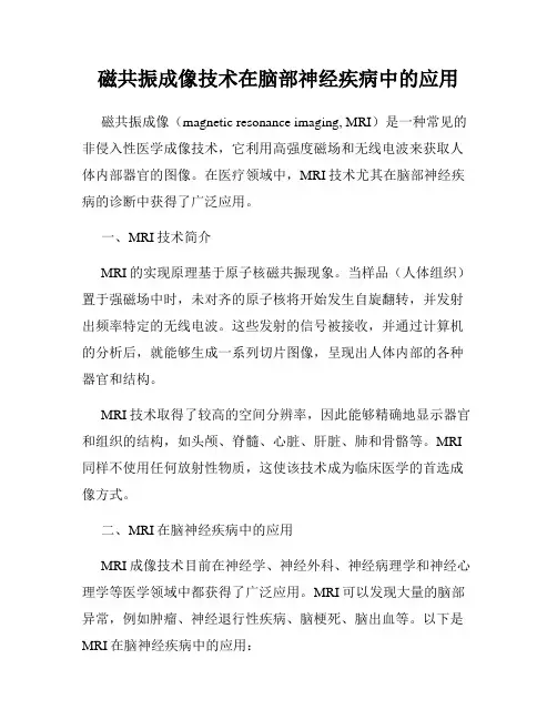 磁共振成像技术在脑部神经疾病中的应用
