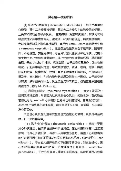 风心病—搜狗百科