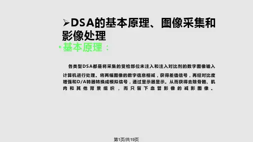 DSA检查技术PPT课件