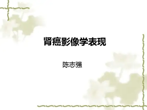 肾癌影像学表现