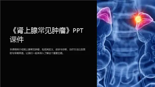 《肾上腺常见肿瘤》课件