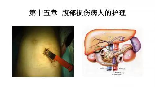 腹部损伤病人的护理