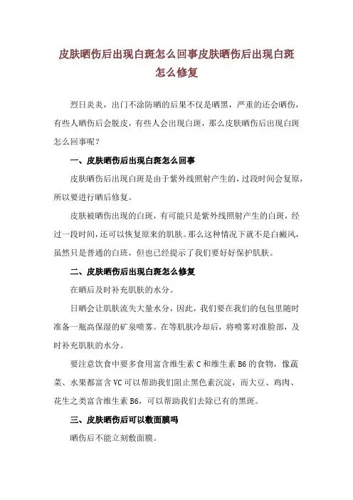 皮肤晒伤后出现白斑怎么回事 皮肤晒伤后出现白斑怎么修复