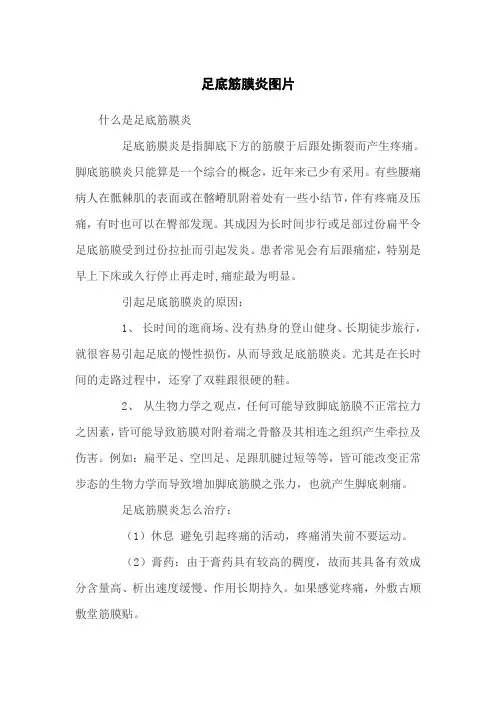 足底筋膜炎图片