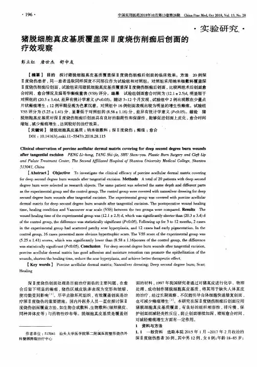 猪脱细胞真皮基质覆盖深Ⅱ度烧伤削痂后创面的疗效观察