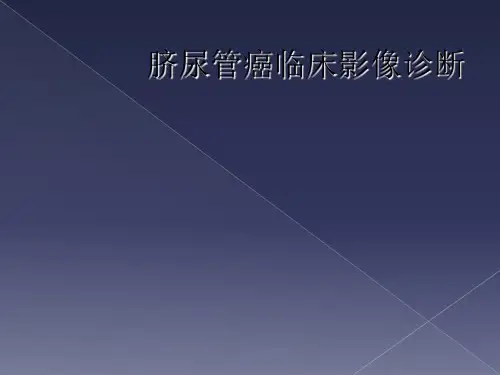 脐尿管癌临床影像诊断