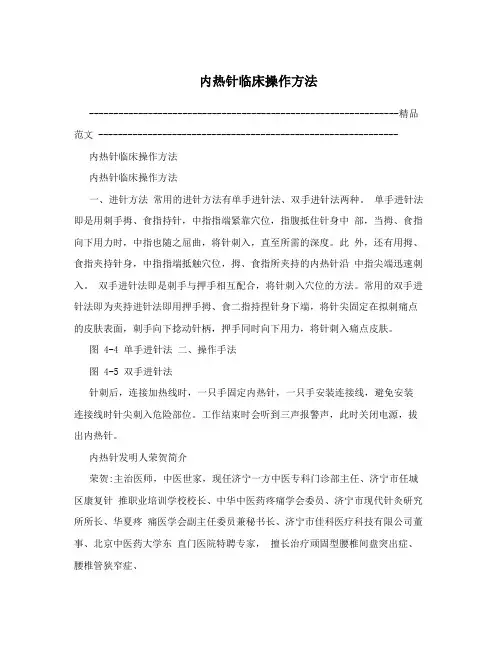 内热针临床操作方法