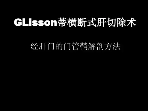 GLisson蒂横断式肝切除术  经肝门的门管鞘解剖方法