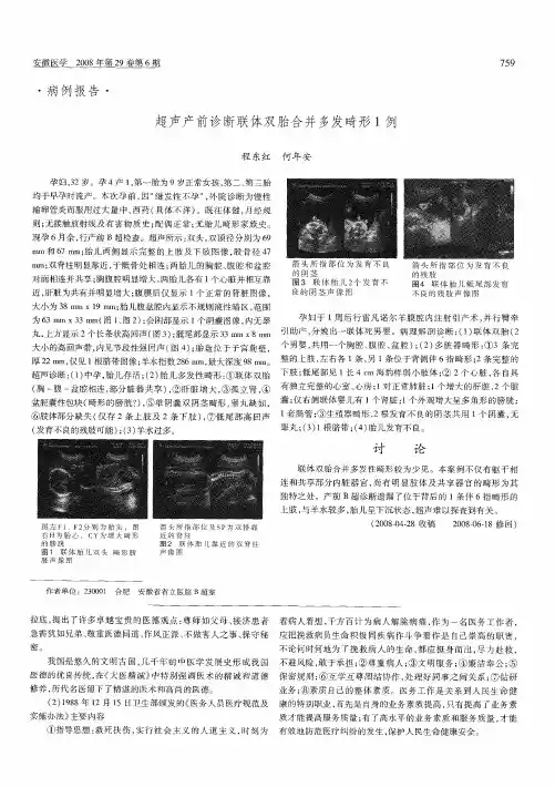 超声产前诊断联体双胎合并多发畸形1例