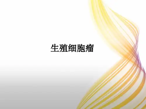 生殖细胞瘤ppt课件