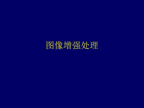 图像增强处理课件