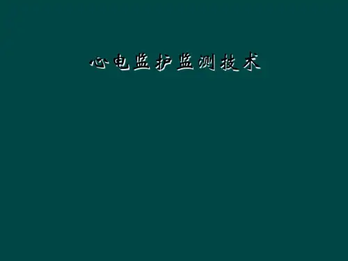心电监护监测技术