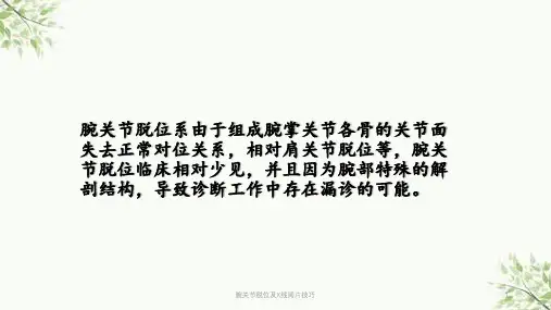 腕关节脱位及X线阅片技巧课件