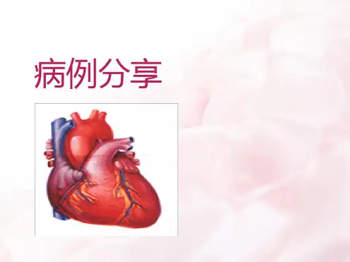 《酒精性心肌病》ppt课件
