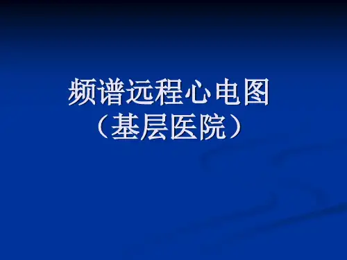 频谱远程心电图(基层医院)
