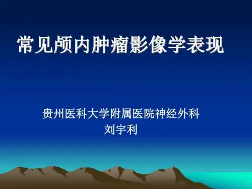 常见颅内肿瘤影像学表现
