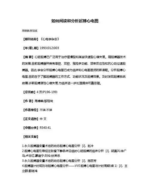 如何阅读和分析起搏心电图