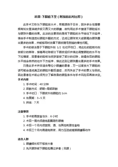 科普-下眼睑下至（附加前后对比照）