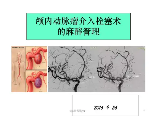 颅内动脉瘤介入栓塞术的麻醉管理 (1)ppt课件