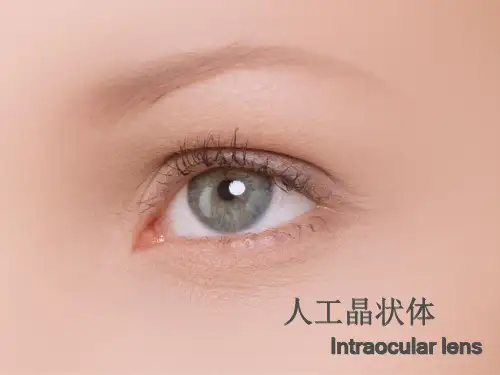 人工晶体课件资料