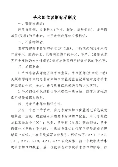 手术部位识别标示制度