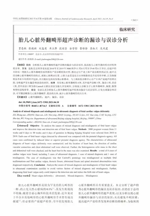 胎儿心脏外翻畸形超声诊断的漏诊与误诊分析