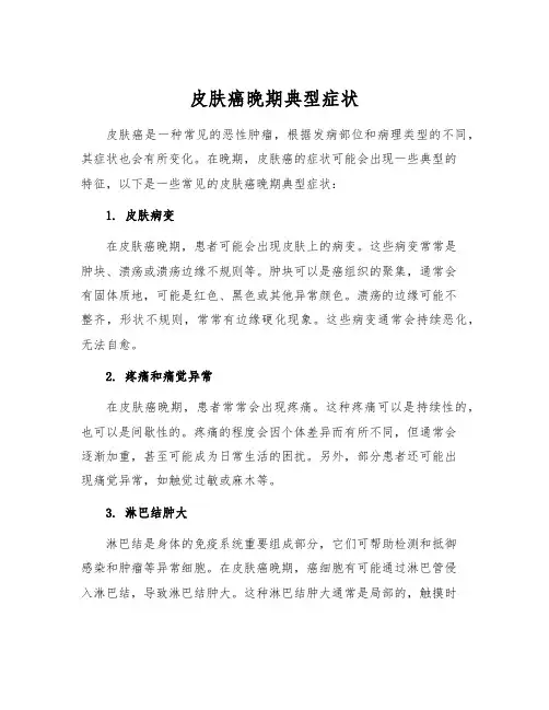 皮肤癌晚期典型症状