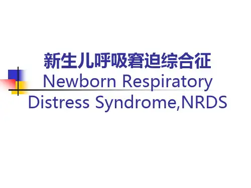 nrds